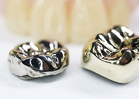 宮古島 高輪アイランドクリニック 金歯や銀歯、体内に蓄積された金属